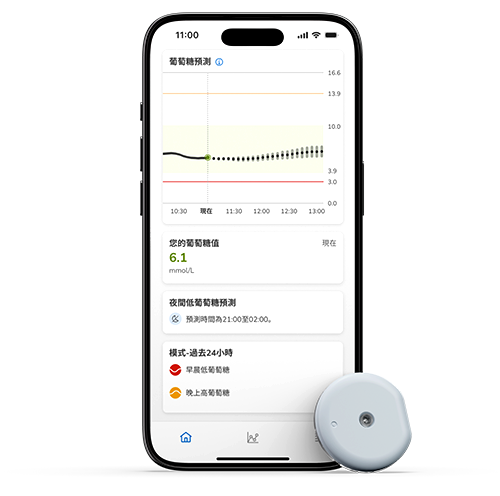 此圖片顯示SmartGuide敷貼器、Accu-Chek連續葡萄糖監測解決方案和SmartGuide 全智航應用程式畫面。