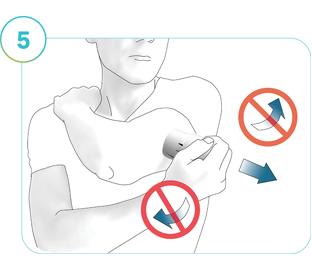 Illustration of Step 5:  The direction to remove the applicator from the application site.