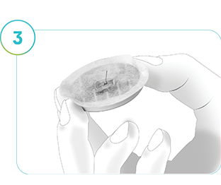 Image showing the SmartGuide CGM removed from the skin.