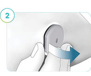 The image depicts how to remove the SmartGuide sensor.