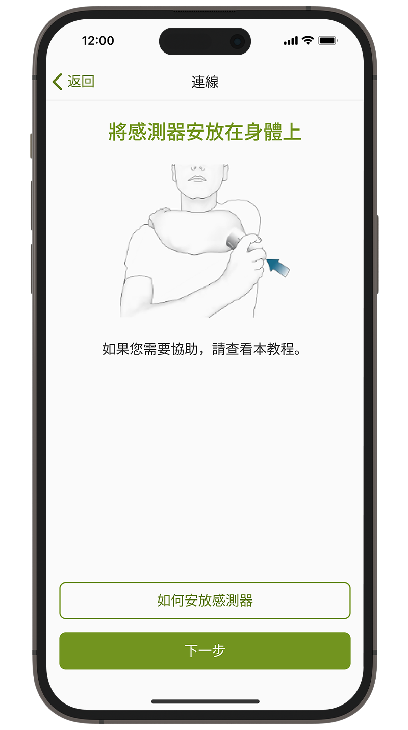 mySugr應用程式配對套用感測器的畫面。